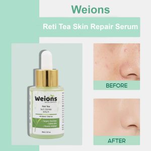 WEIONS RETINOL SKIN REPAIR SERUM -30 ML